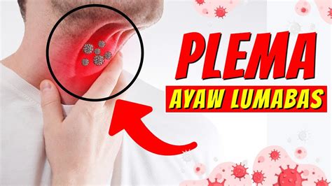 gamot sa plema na ayaw lumabas|Home Remedies kapag may Plema Ka sa Baga na Ayaw Lumabas.